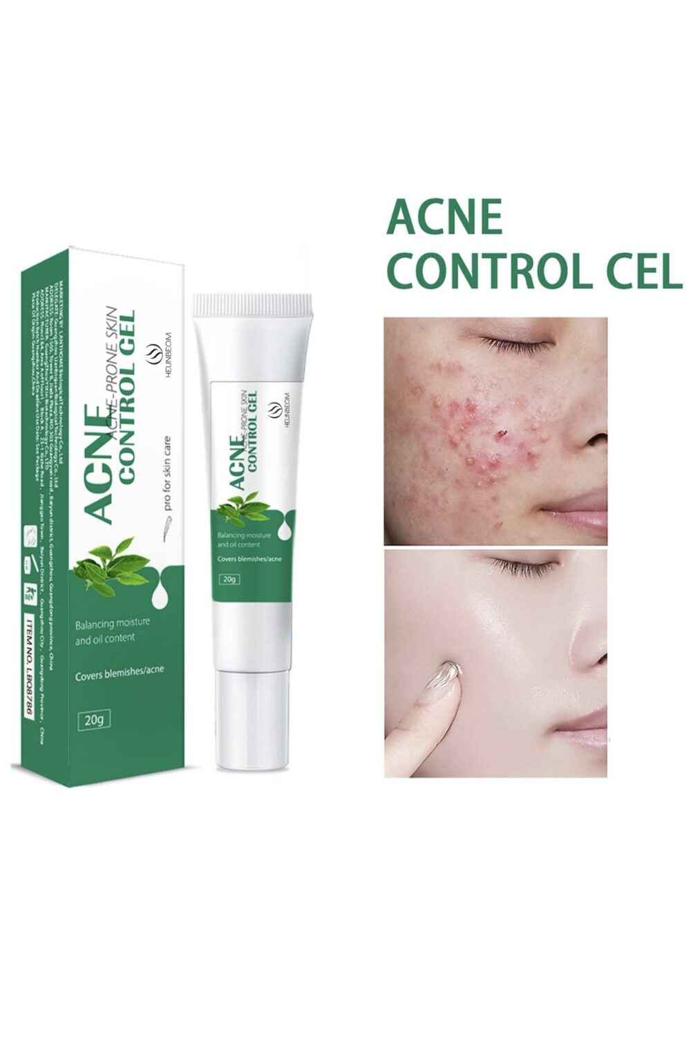 Acne Traces Cream Acne Scars Repair Cream Adolescent Acne Cream