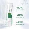 Acne Traces Cream Acne Scars Repair Cream Adolescent Acne Cream - Image 2